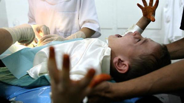 An Algerian boy screams while a doctor circumcises him during a mass circumcision at a local hospital in Algiers City 09 October 2007. The Islam religion stresses cleanliness, and circumcision in many Islamic nations is considered a form of natural hygiene, with the event being often viewed communally as a joyous occasion and celebrated. AFP PHOTO/FAYEZ NURELDINE (Photo credit should read FAYEZ NURELDINE/AFP/Getty Images)