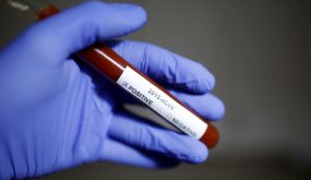 الصين : ارتفاع وفيات فيروس كورونا الى 2870