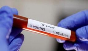 مادبا : نتائج ٥٣٠ فحصا بفيروس كورونا سلبية