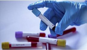 تسجيل اربع اصابات جديدة بكورونا في غور الصافي